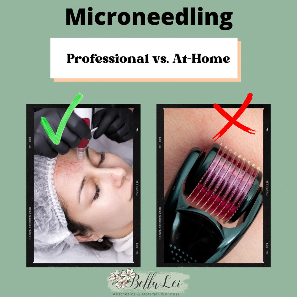 real vs fake microneedling bella lei Fleming Island