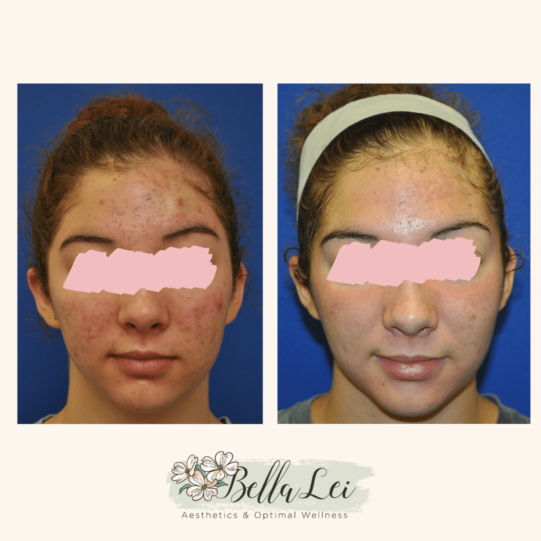 smooth skin bella lei fleming island fl