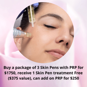 skin pen prp Bella lei 