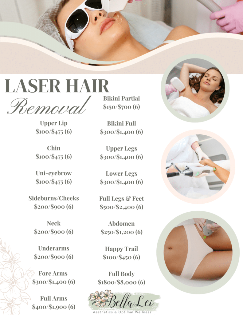 laser hair removal bella Lei 