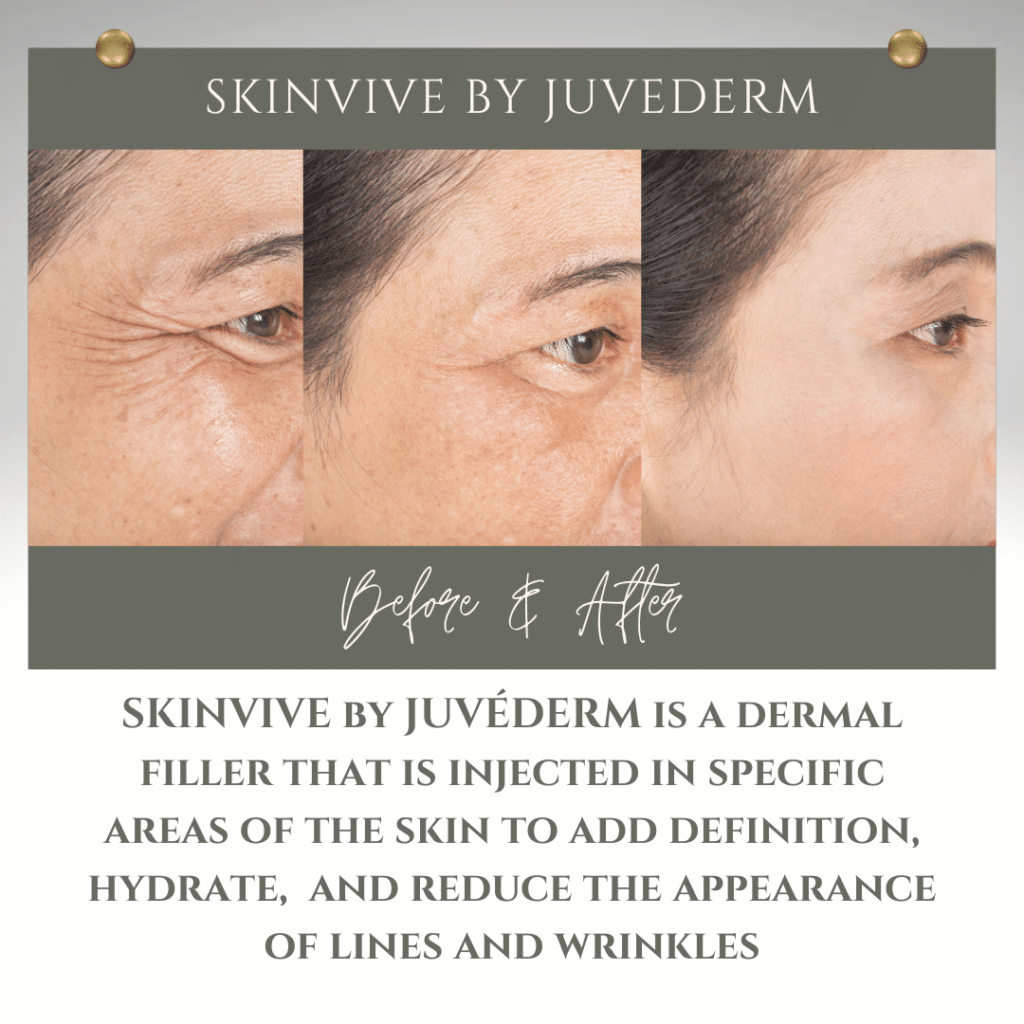 Skinvive by juvederm