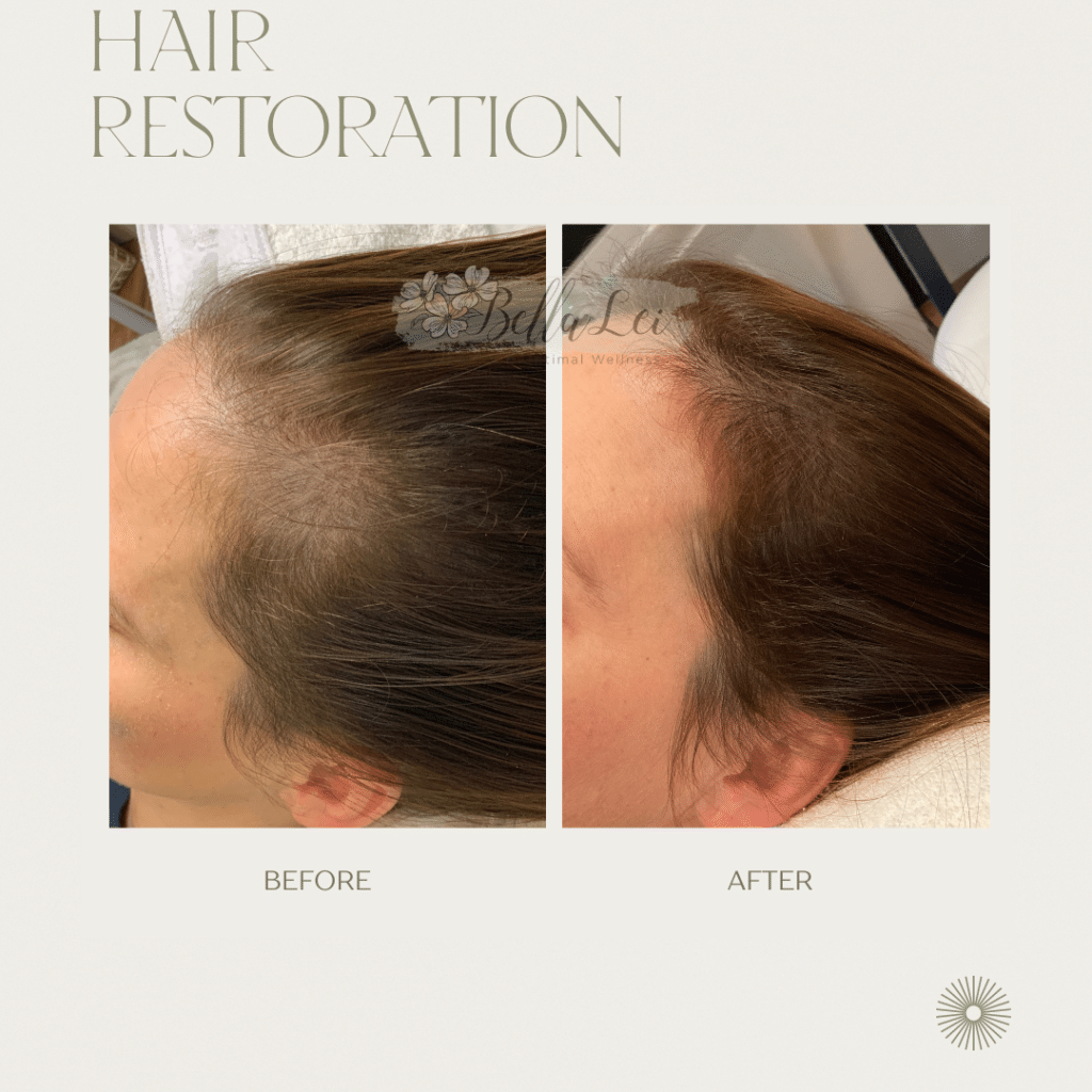 hair restoration fleming island